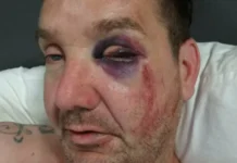 Airen: Spendenkampagne nach schwerem Unfall Autor Airen nach seinem Unfall in Mexiko (Foto: GoFundMe)